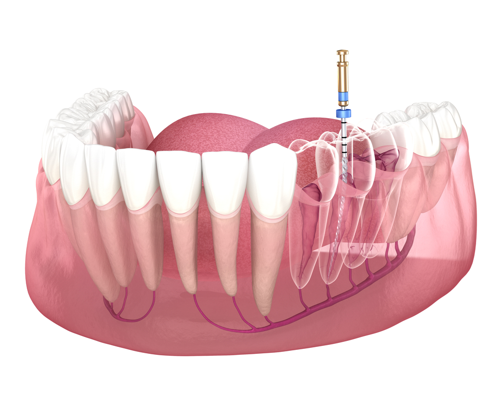 root canals thornton Dr. Scott Bruggeman. Bruggeman Dental. General, Cosmetic, Restorative, Family Dentistry Dentist in Thornton, CO 80023