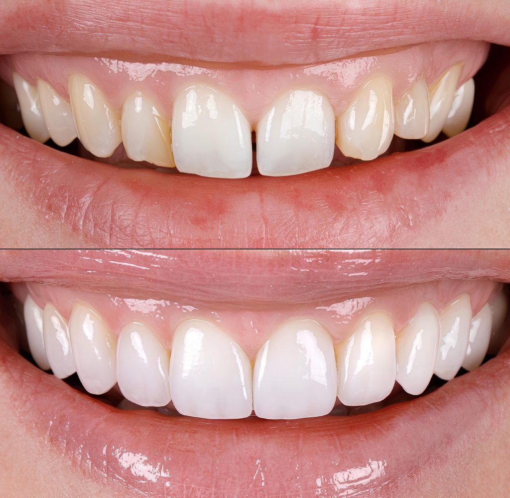 thornton restorative dentistry